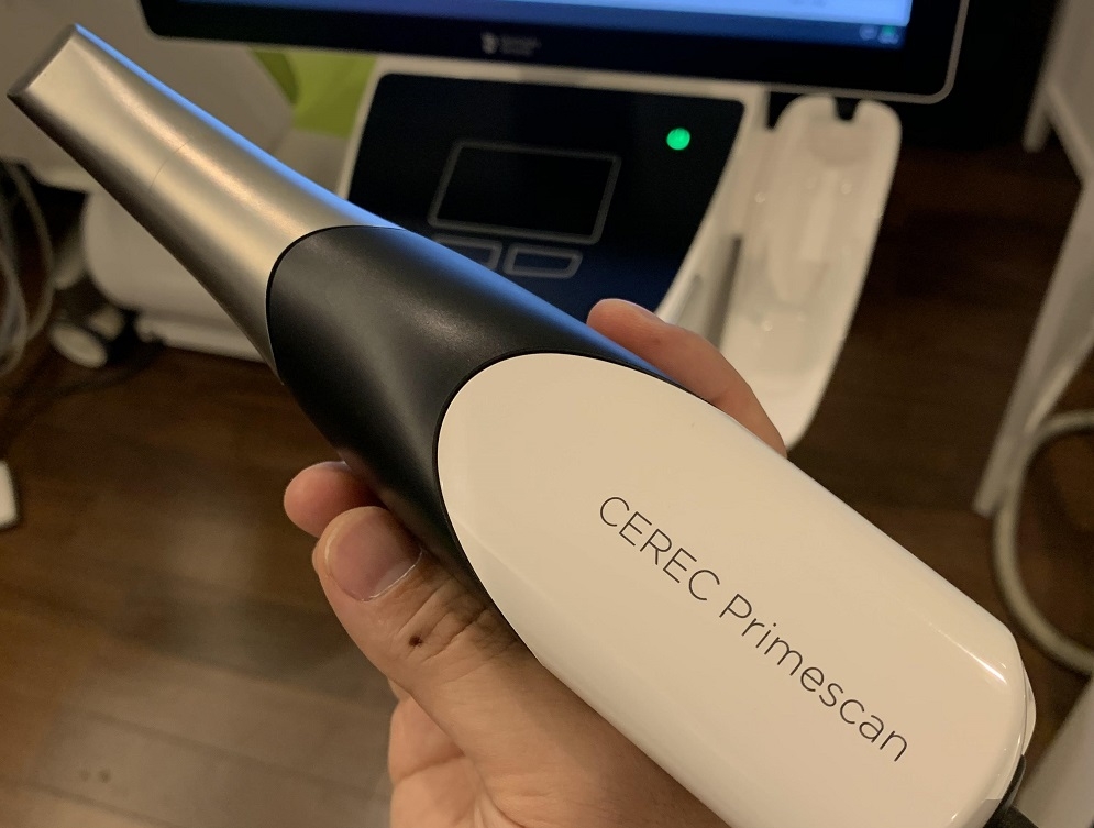 虫歯の最先端治療　『CEREC（セレック）』とは